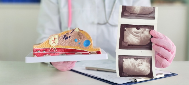 Фиброаденома молочной железы – симптомы, диагностика, лечение