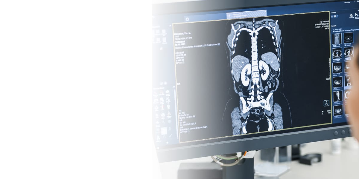 КТ селезенки