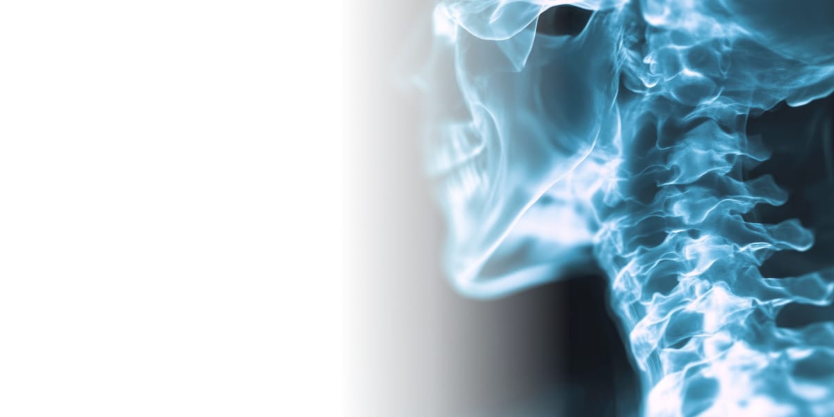 КТ шеи с контрастом