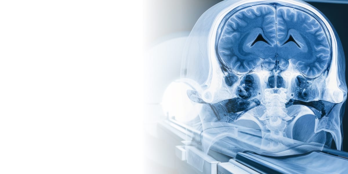 КТ сосудов в Москве: современная диагностика в YourMed